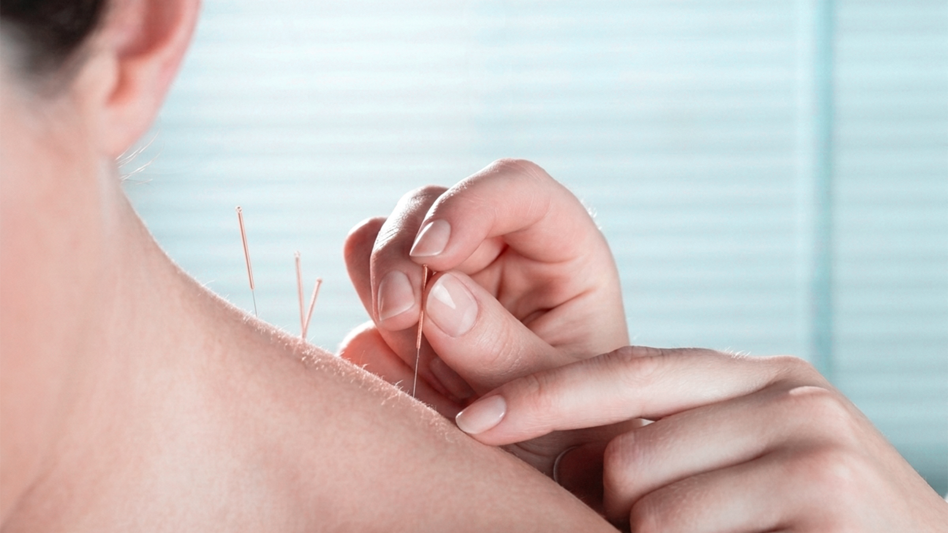 Acupuntura